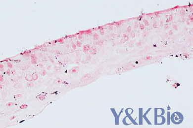 黑龙江masson银染