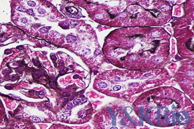 黑龙江六胺银染色