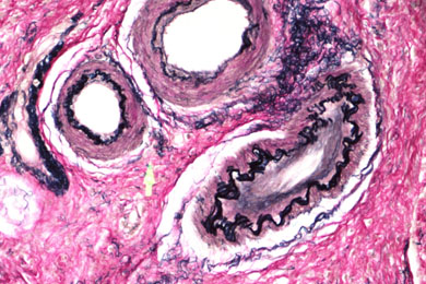 黑龙江弹力纤维染色