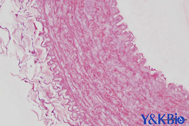 黑龙江茜素红染色