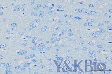 黑龙江尼氏染色