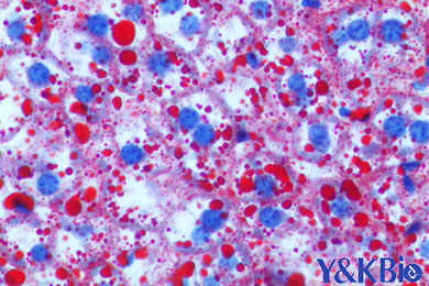 黑龙江油红O染色