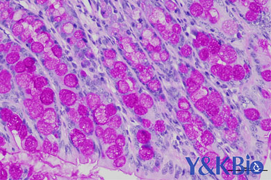 黑龙江糖原PAS染色