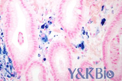 黑龙江普鲁士蓝染色