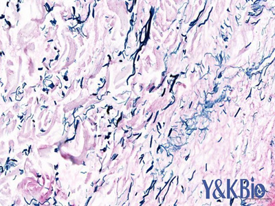 黑龙江维多利亚蓝染色