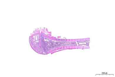 黑龙江脱钙（慢脱）