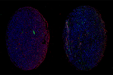 黑龙江组织芯片免疫荧光单标（双色）染色