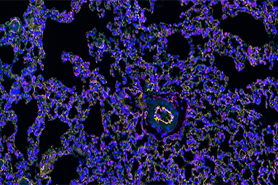 黑龙江组织芯片免疫荧光双标（三色）染色