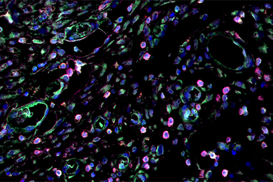 黑龙江普通切片（荧光三标 四色）扫描