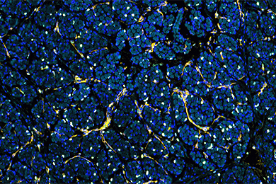 黑龙江普通切片（荧光四标 五色）扫描