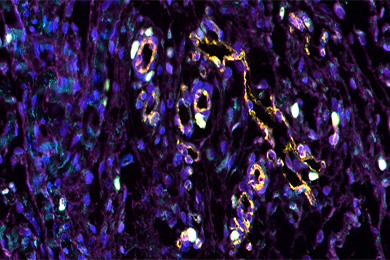 黑龙江普通切片（荧光五标