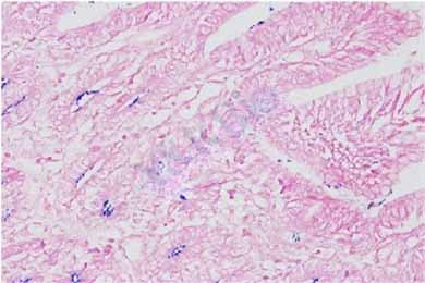 黑龙江革兰氏染色