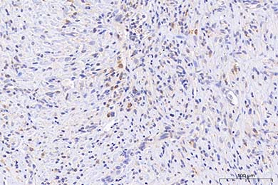 黑龙江Anti-iNOS Antibody