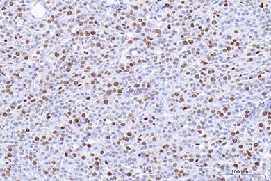 黑龙江Anti-Ki67 Antibody [SR00-02]