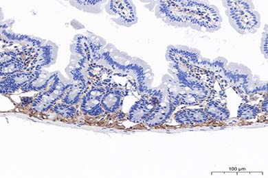 黑龙江Anti-MMP-2 Antibody [PSH11-26]